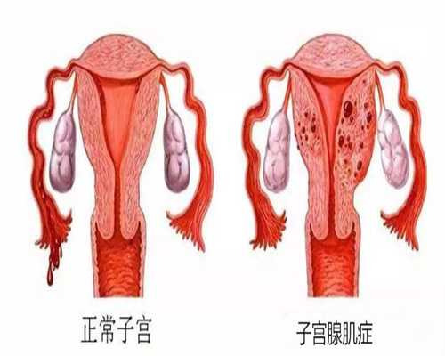 中国国内代孕机构_避孕新选择：新一代口服避孕药