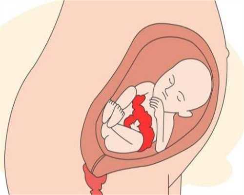 合法助孕咨询_五个月宝宝辅食食谱 宝宝的辅食食谱怎么做
